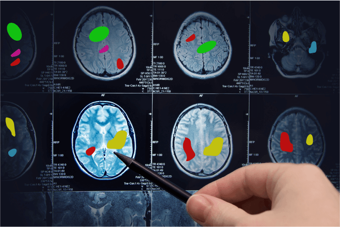 Image annotation in the medical field